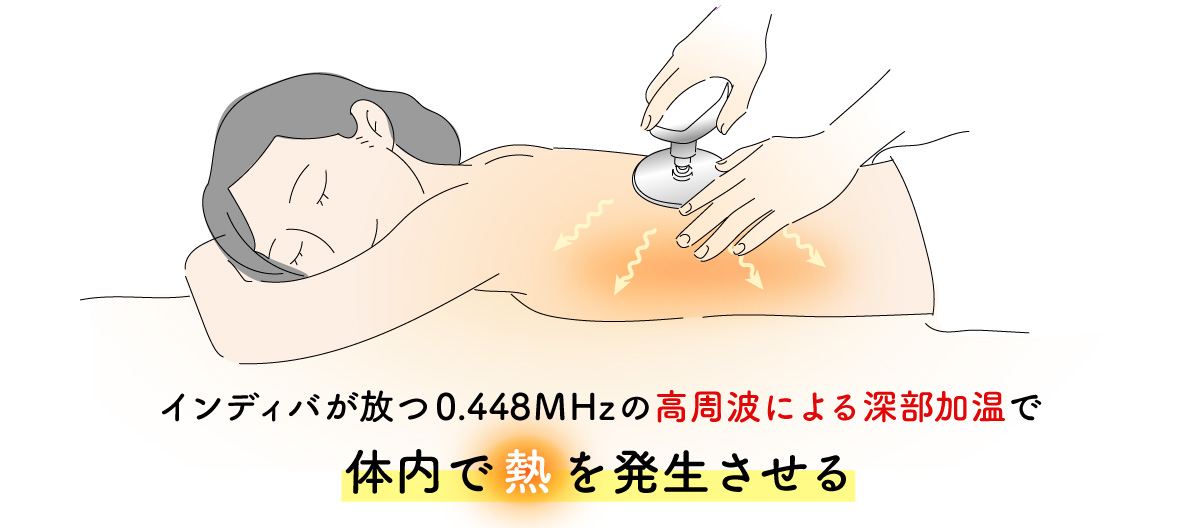 インディバは体内で熱を発生させる