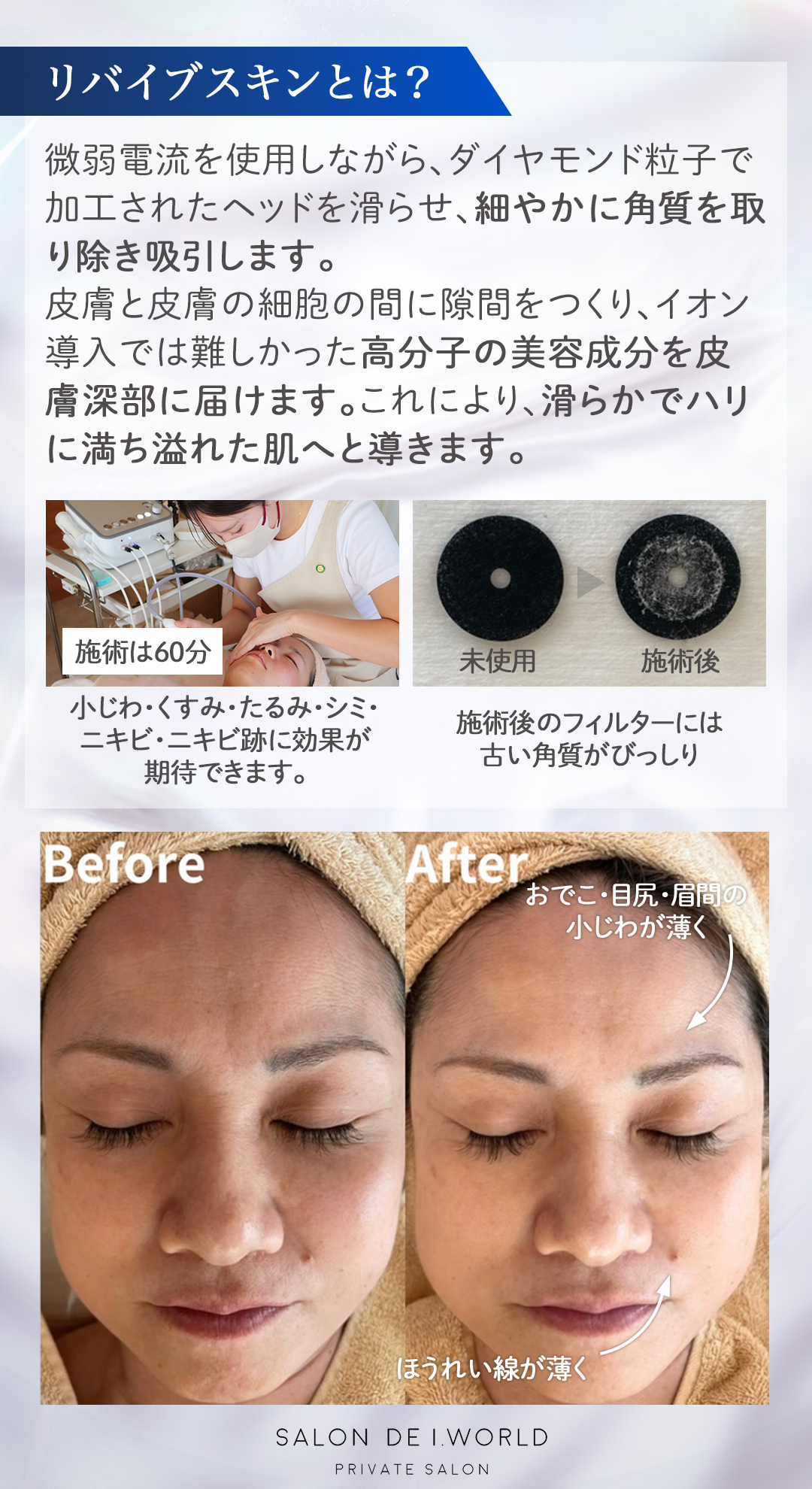 リバイブスキンについて